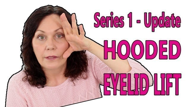 'Droopy Eyelid Remedy - Facerobics Facial Exercises'