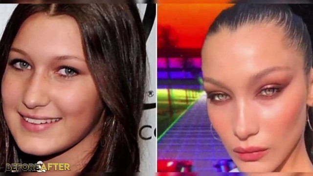 'Bella Hadid  Before and After Transformations  Plastic Surgery Rumors, Make Up, Fitness & More'